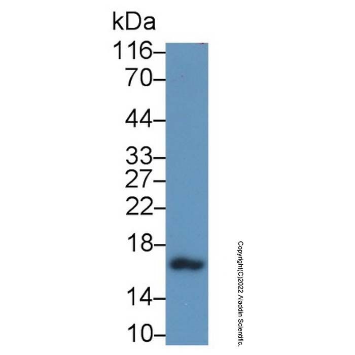 Calcitonin/CALCA Antibody