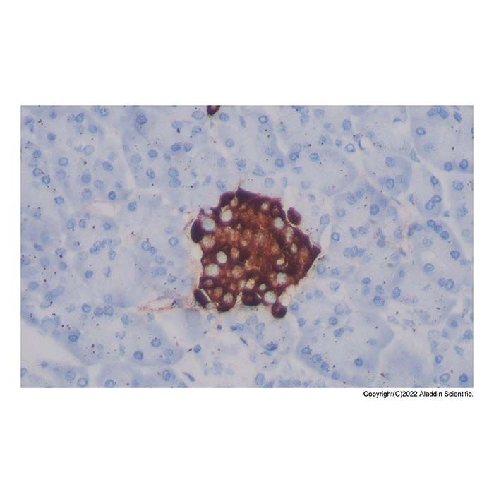 Recombinant Chromogranin A Antibody