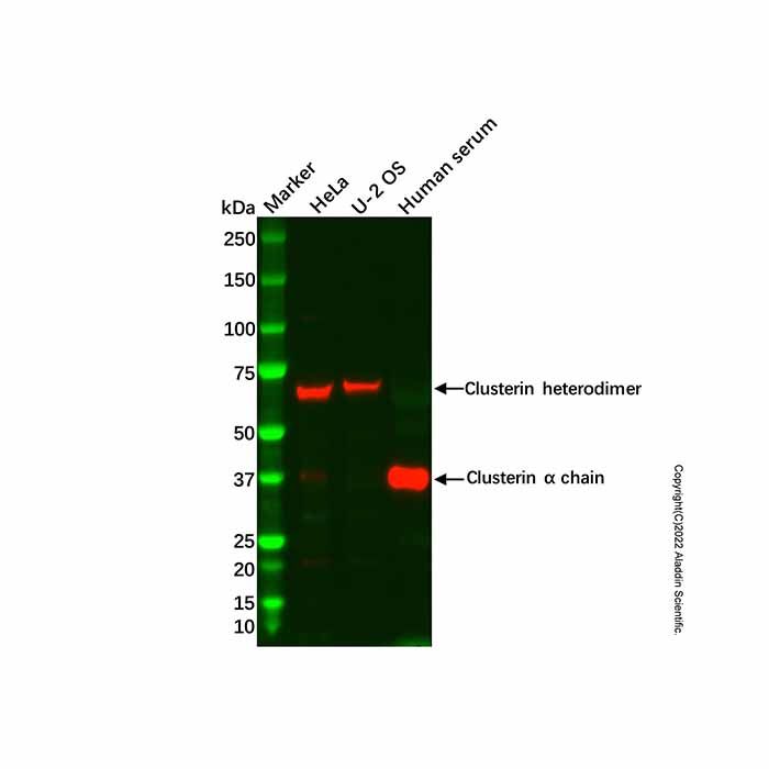 Recombinant Clusterin Antibody