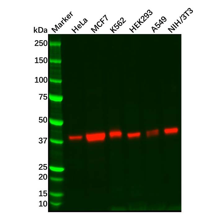 Recombinant CT A Antibody