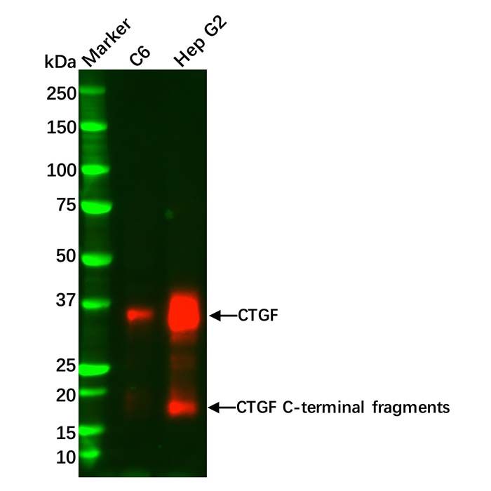 Recombinant CTGF Antibody