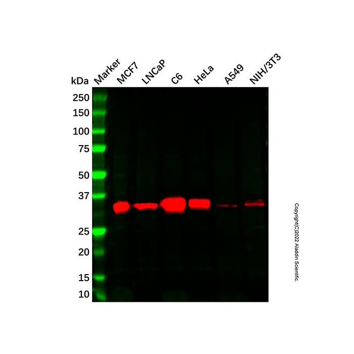 Recombinant Cyclin D1 Antibody