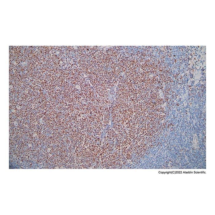 Recombinant Cyclin D1 Antibody