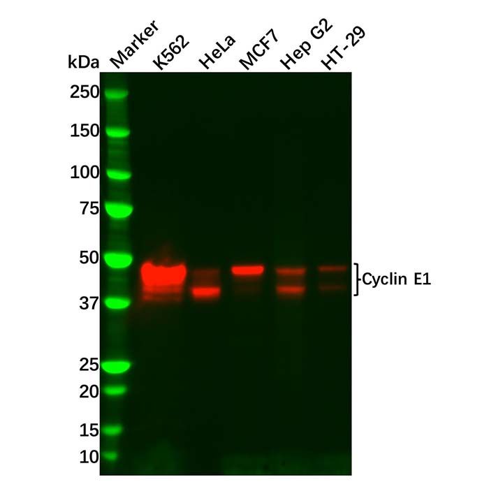 Recombinant Cyclin E1 Antibody