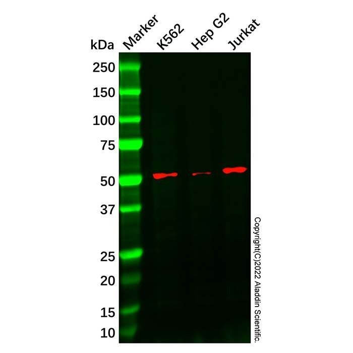 Recombinant Cytochrome P450 17A1/CYP17A1 Antibody