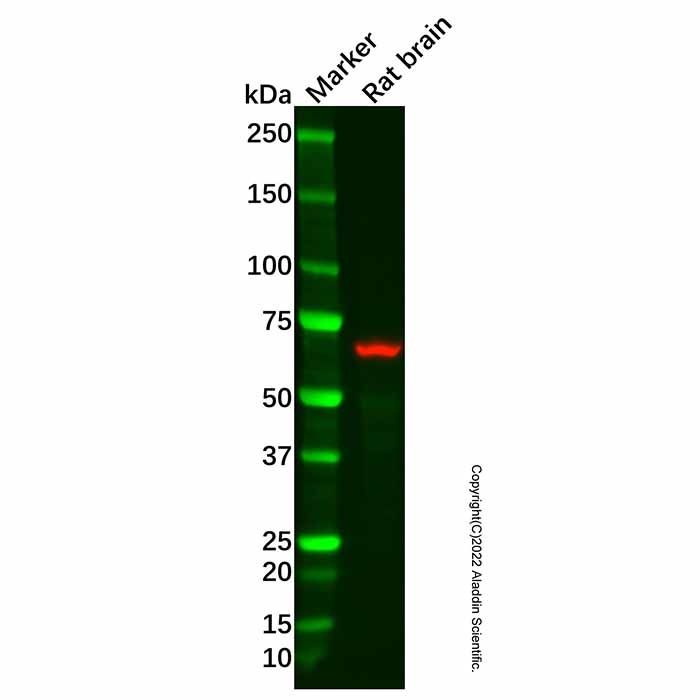 Recombinant Cytokeratin 1 Antibody