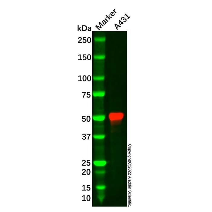 Recombinant Cytokeratin 13 Antibody