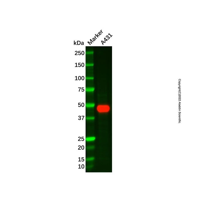 Recombinant Cytokeratin 15 Antibody