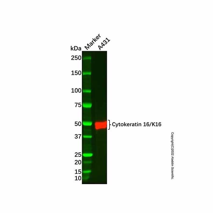 Recombinant Cytokeratin 16/K16 Antibody