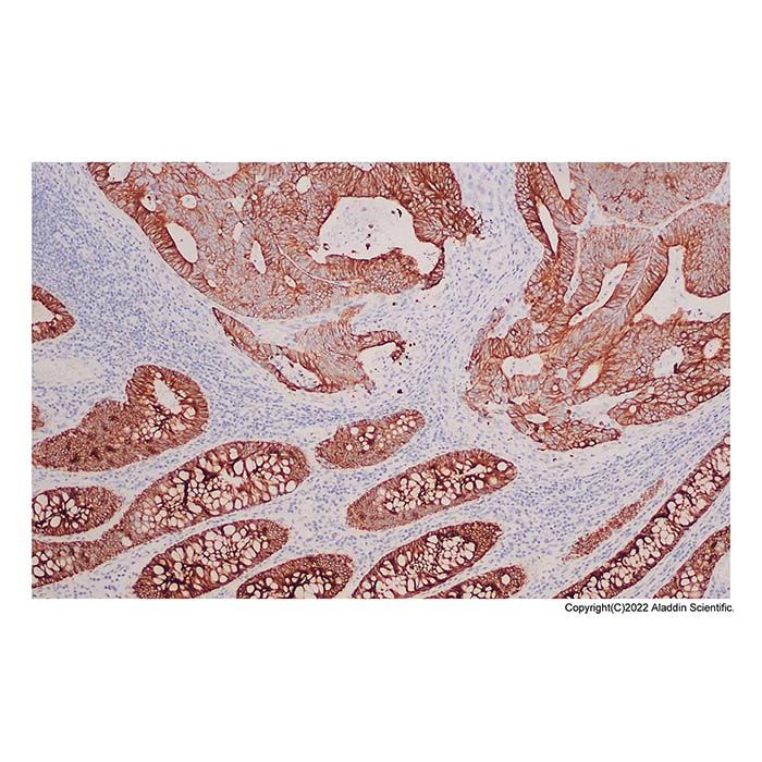 Recombinant Cytokeratin 19 Antibody