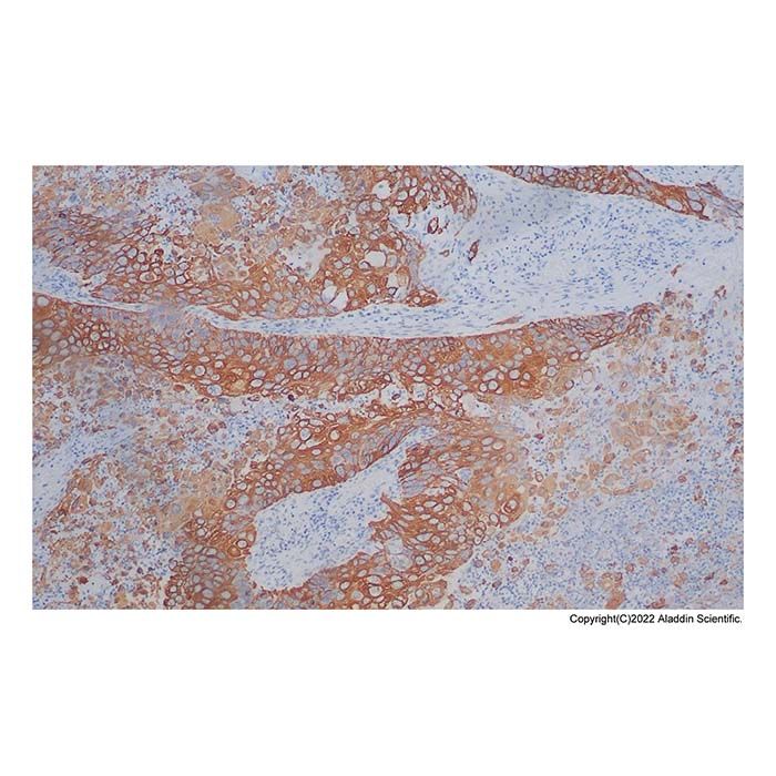 Recombinant Cytokeratin 5 + 6 Antibody