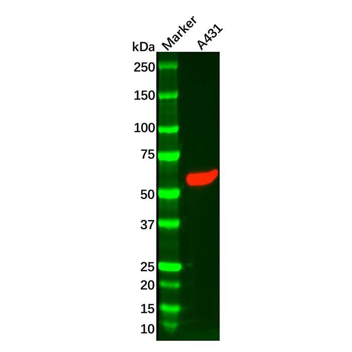 Recombinant Cytokeratin 5 Antibody