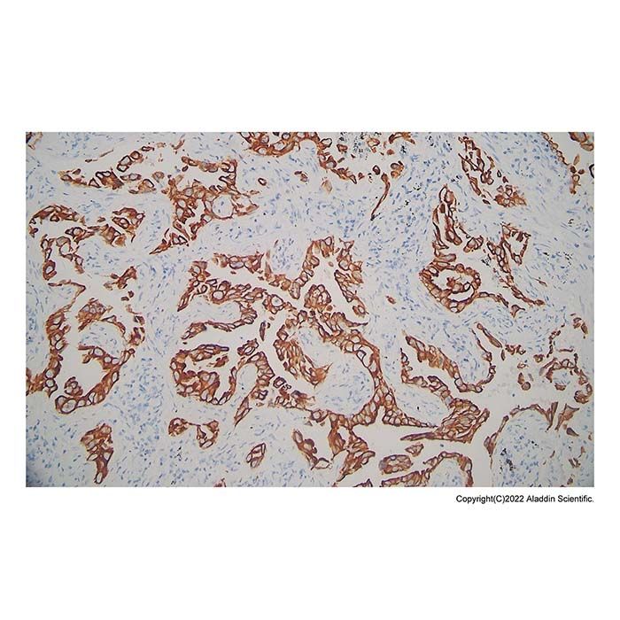 Recombinant Cytokeratin 7 Antibody