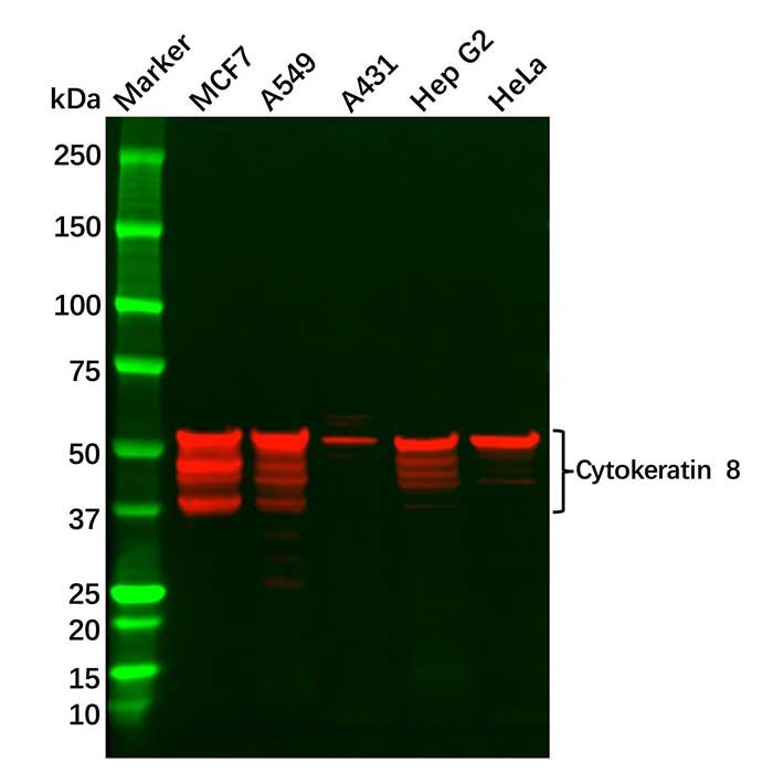 Cytokeratin 8 Antibody