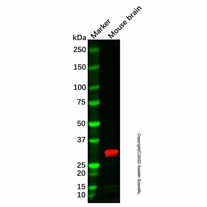 Recombinant DARPP32 Antibody
