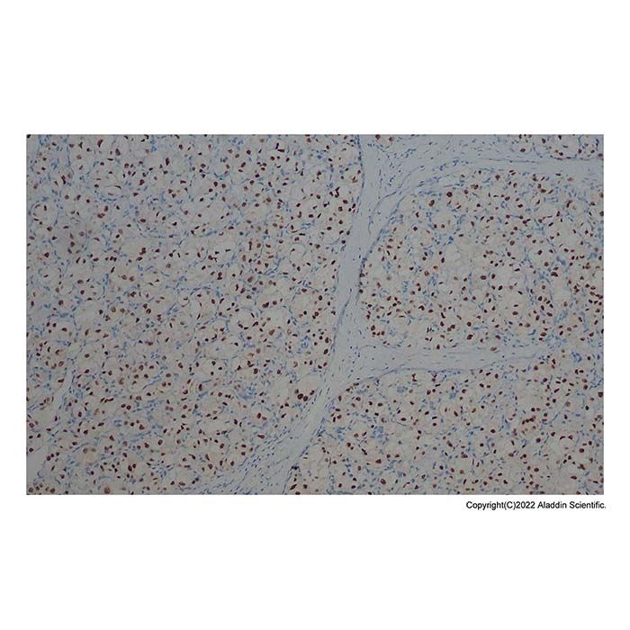 Recombinant delta 1 Catenin/CAS Antibody