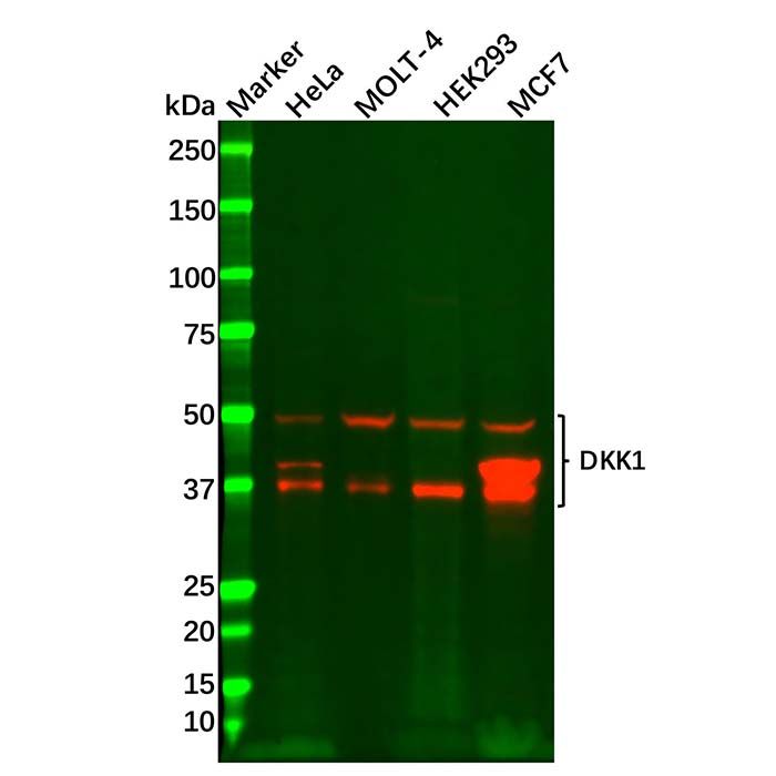 Recombinant DKK1 Antibody
