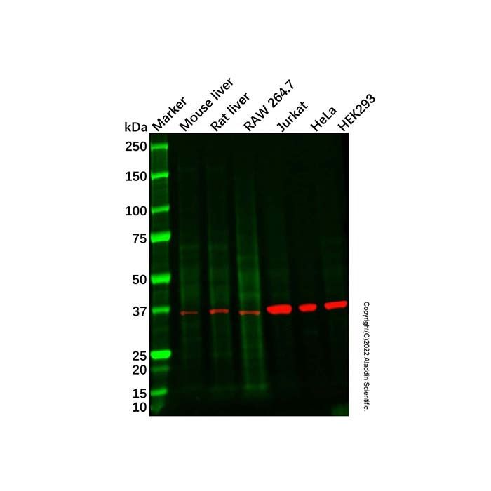 E3 ubiquitin-protein ligase MUL1 Antibody