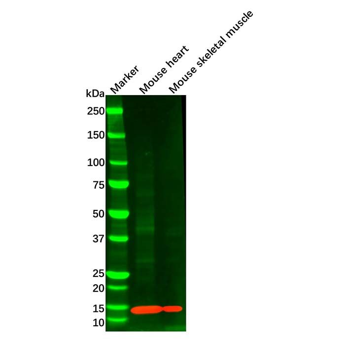FABP4 Mouse mAb