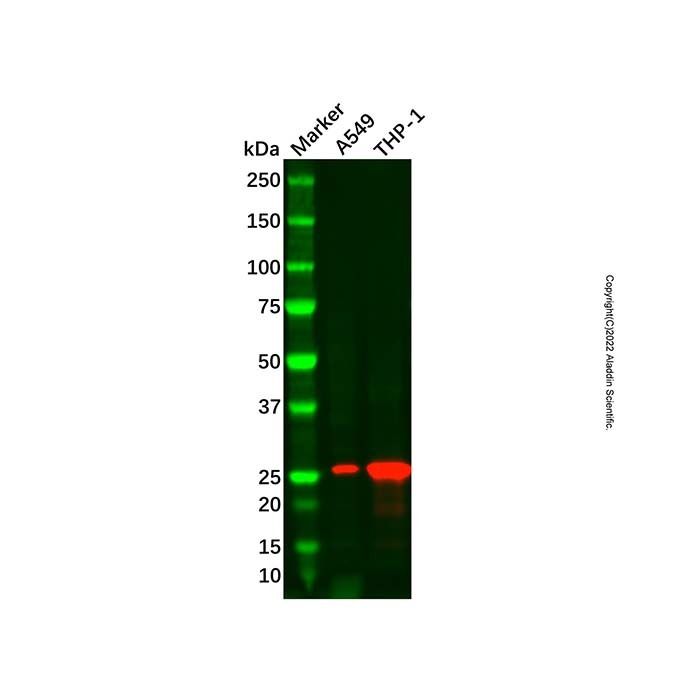 Recombinant Factor D/CFD Antibody