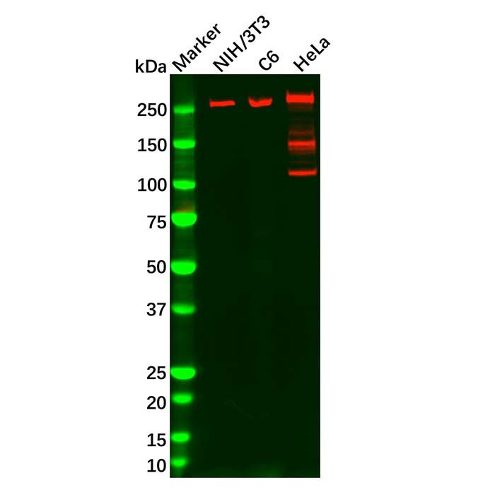 Fatty Acid Synthase Mouse mAb