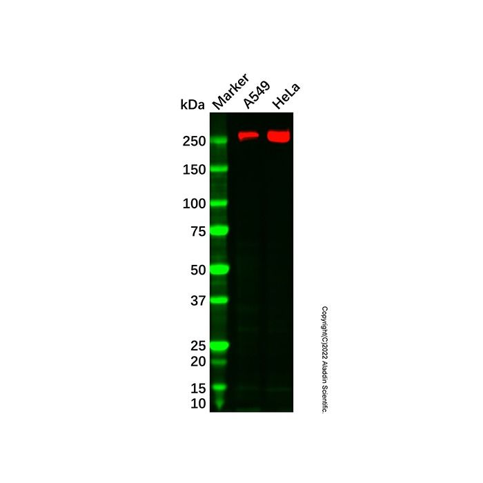 Recombinant Fatty Acid Synthase Antibody