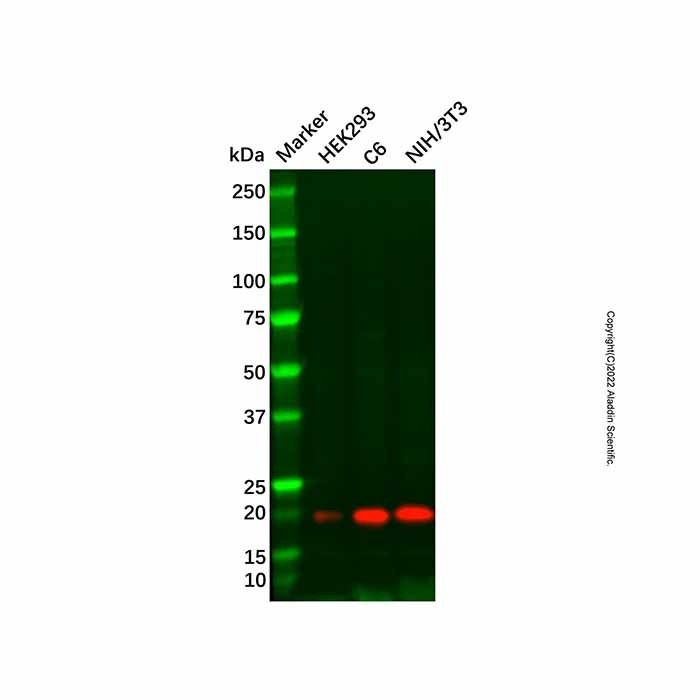 Recombinant Ferritin Antibody