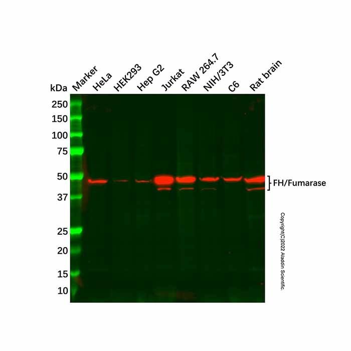 Recombinant FH/Fumarase Antibody