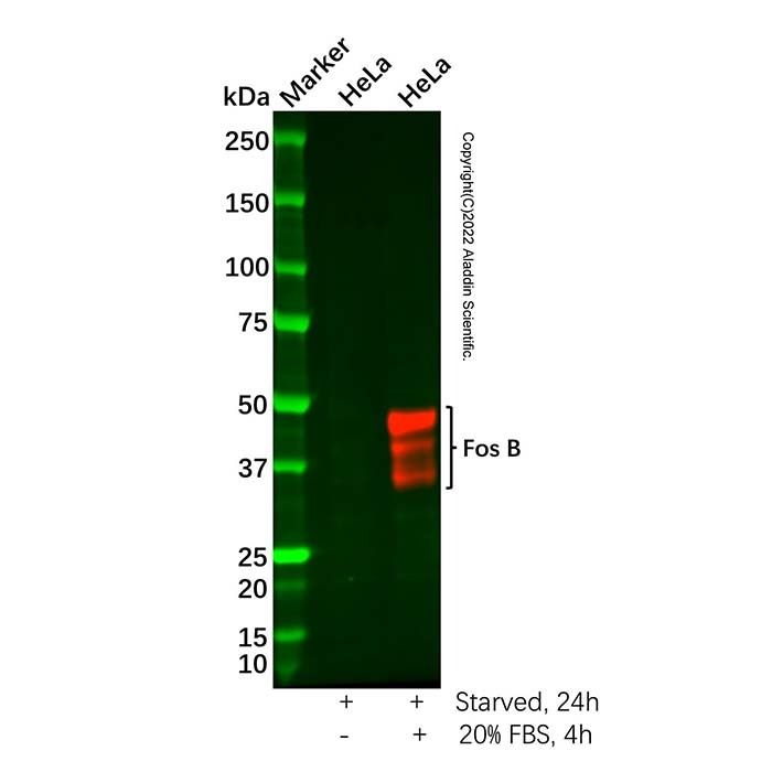 Recombinant Fos B Antibody