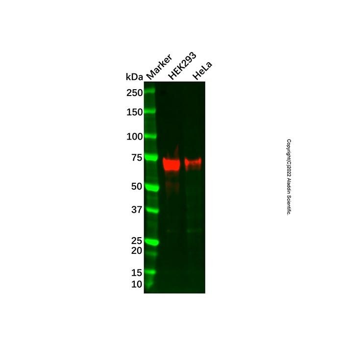 Recombinant FOXC1 Antibody