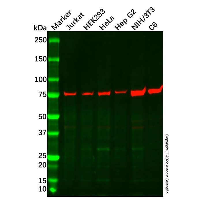 Recombinant GARS Antibody