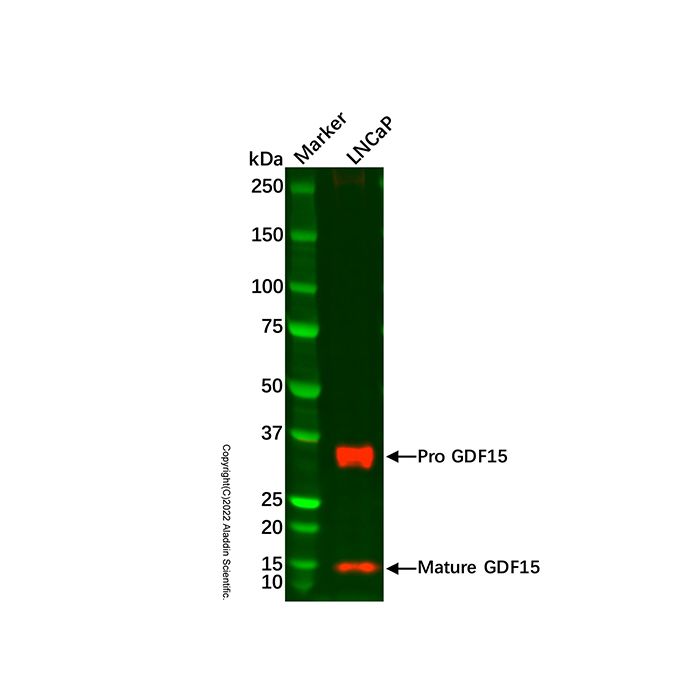 Recombinant GDF15 Antibody
