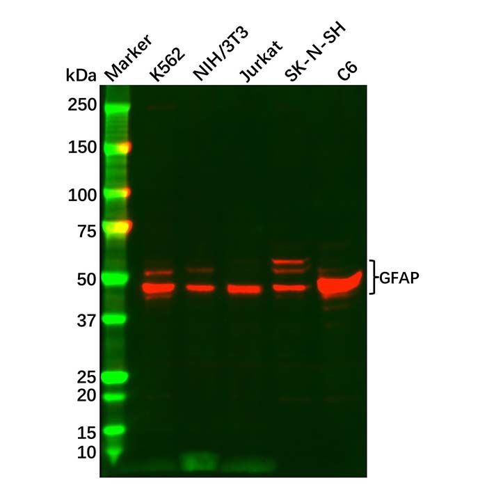 GFAP Antibody