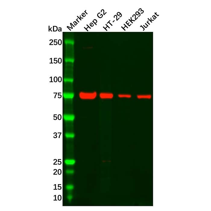 Recombinant GFPT1 Antibody