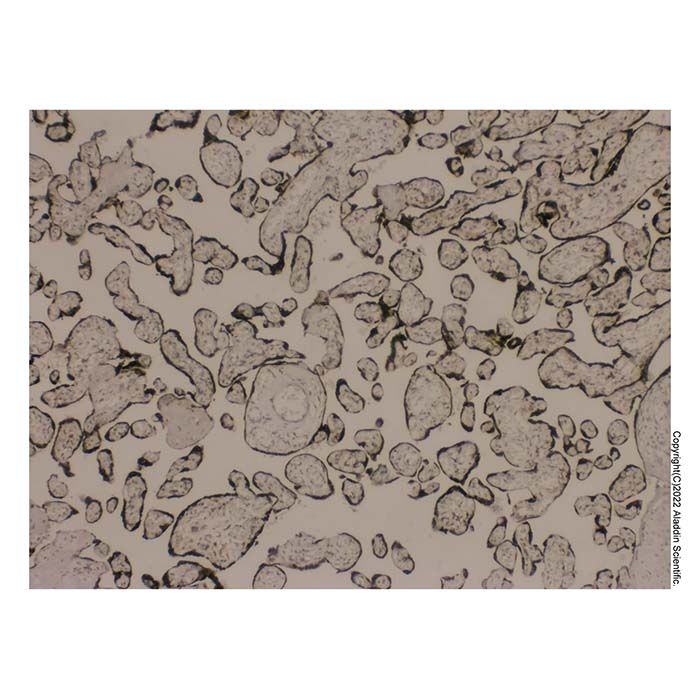 hCG Antibody