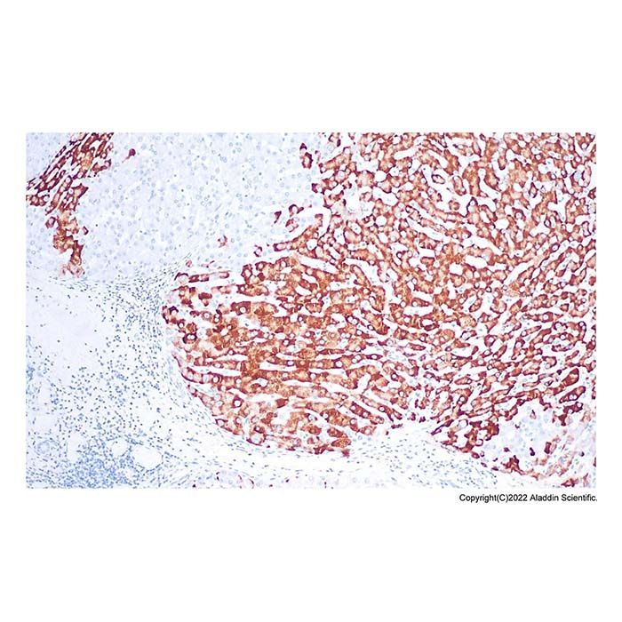 Recombinant Hepatitis B Virus Surface Antigen (Ad/Ay) Antibody