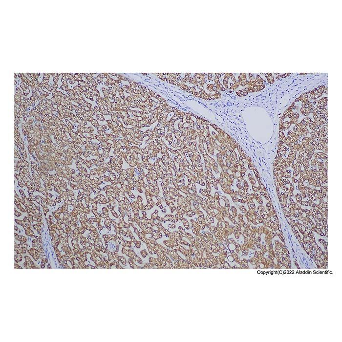 Recombinant Hepatocyte Specific Antigen Antibody