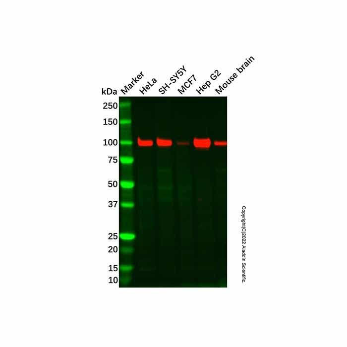 Recombinant Hexokinase II Antibody