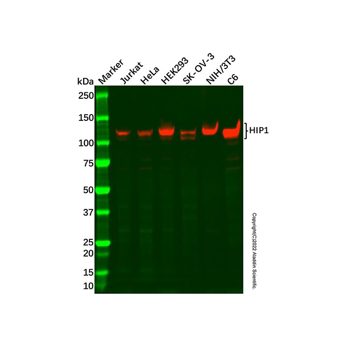 Recombinant HIP1 Antibody