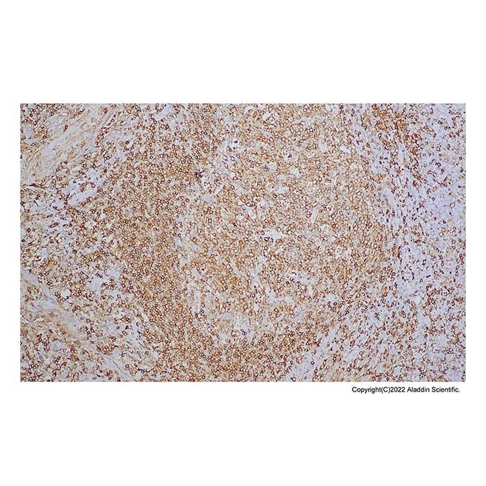 Recombinant HLA-DR Antibody