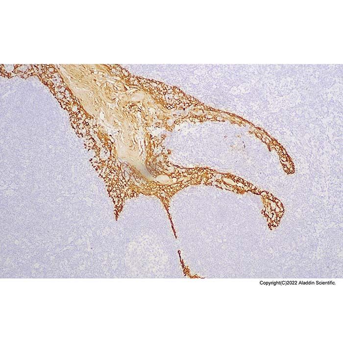 Recombinant HMW Cytokeratin Antibody