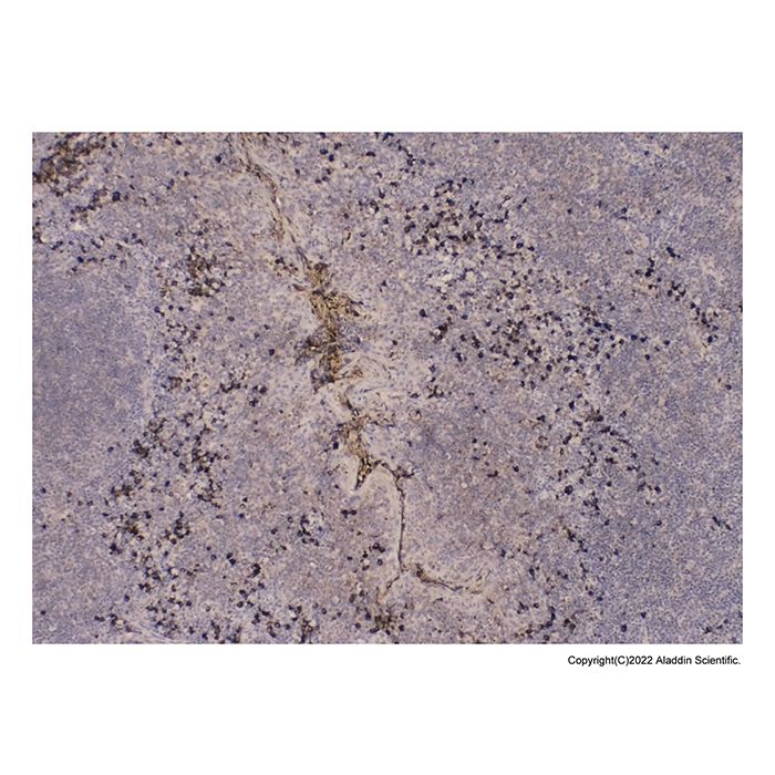 Human IgG Antibody