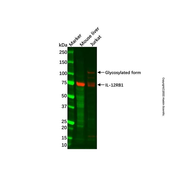 IL-12RB1 Antibody