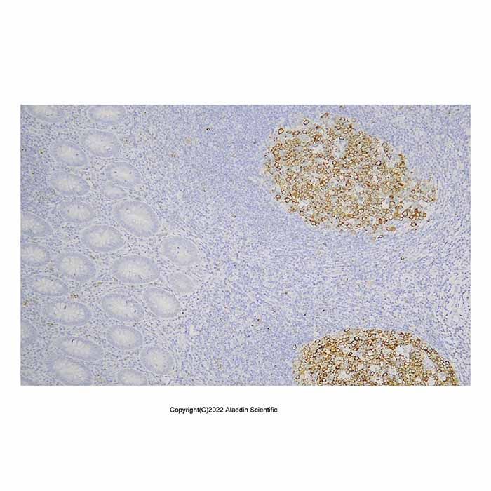 Recombinant IMP3 Antibody