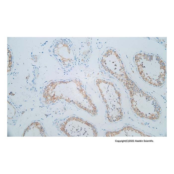 Recombinant Inhibin alpha Antibody