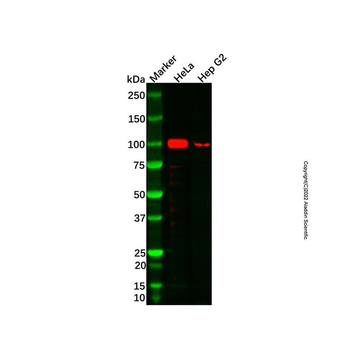 Recombinant Insulin Receptor Antibody