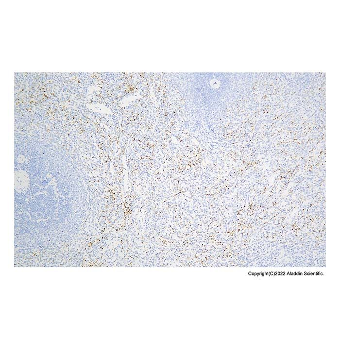 Recombinant Integrin beta 3 Antibody
