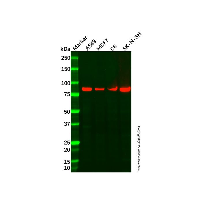 Recombinant Kaiso Antibody