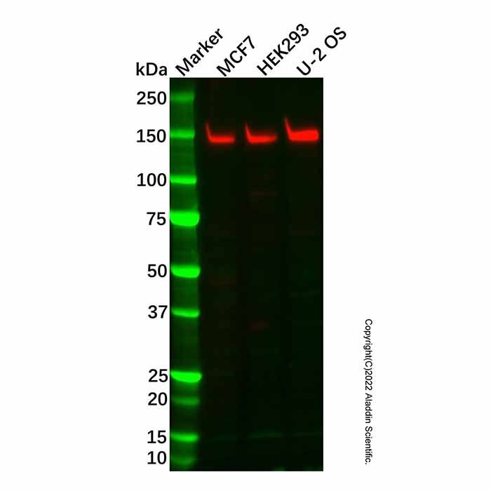 Recombinant KDM4A/JHDM3A/JMJD2A Antibody