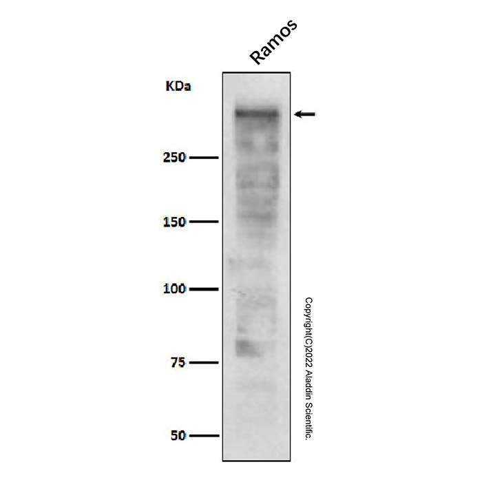 Recombinant Ki67 Antibody